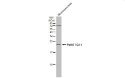 Invitrogen PARK7 Monoclonal Antibody (GT136) 100 &mu;L | Buy Online | Invitrogen&trade; | Fisher Scientific