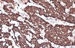 Invitrogen IKK beta Monoclonal Antibody (GT685) 100 &mu;L; Unconjugated:Antibodies,