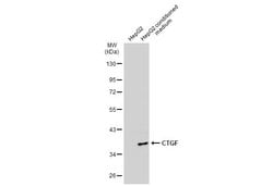 Invitrogen CTGF Monoclonal Antibody (GT7812) 100 &mu;L; Unconjugated:Antibodies,