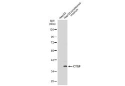 Invitrogen CTGF Monoclonal Antibody (GT8610) 100 &mu;L | Buy Online | Invitrogen&trade; | Fisher Scientific