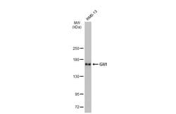 Invitrogen GLI1 Monoclonal Antibody (GT249) 100 &mu;L; Unconjugated:Antibodies,