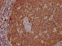 Invitrogen PKM Monoclonal Antibody (6C3C7) 100 &mu;L; Unconjugated:Antibodies,