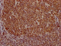 Invitrogen PKM Monoclonal Antibody (6C3C7) 100 &mu;L; Unconjugated:Antibodies,