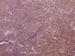 Invitrogen PKM Monoclonal Antibody (6C3C7) 100 &mu;L; Unconjugated:Antibodies,