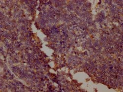 Invitrogen PKM Monoclonal Antibody (6C3C7) 100 &mu;L; Unconjugated:Antibodies,
