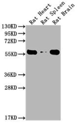 Invitrogen PKM Monoclonal Antibody (6C3C7) 100 &mu;L; Unconjugated:Antibodies,