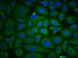 Invitrogen PKM Monoclonal Antibody (4C8E12) 100 &mu;L; Unconjugated:Antibodies,