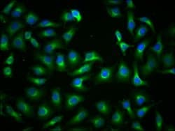 Invitrogen PKM Monoclonal Antibody (4C8E12) 100 &mu;L; Unconjugated:Antibodies,