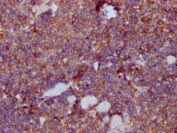 Invitrogen PKM Monoclonal Antibody (4C8E12) 100 &mu;L; Unconjugated:Antibodies,