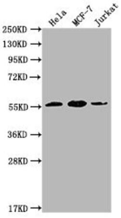 Invitrogen PKM Monoclonal Antibody (4C8E12) 100 &mu;L; Unconjugated:Antibodies,