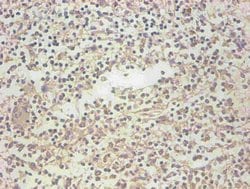 Invitrogen NGAL Monoclonal Antibody (3B1C10) 100 &mu;g; Unconjugated:Antibodies,
