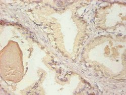 Invitrogen NGAL Monoclonal Antibody (3B1C10) 100 &mu;g; Unconjugated:Antibodies,