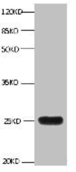 Invitrogen NGAL Monoclonal Antibody (3B1C10) 100 &mu;g; Unconjugated:Antibodies,