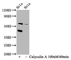Invitrogen Phospho-PKR (Thr446) Recombinant Rabbit Monoclonal Antibody