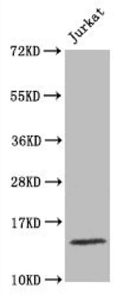 Invitrogen Histone H3 Recombinant Rabbit Monoclonal Antibody (27F2) 100