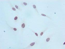 Invitrogen H3K36me1 Recombinant Rabbit Monoclonal Antibody (1F4) 100 &mu;L;