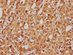 Invitrogen ITGB1 Recombinant Rabbit Monoclonal Antibody (32A10) 100 &mu;L;