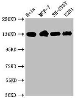 Invitrogen ITGB1 Recombinant Rabbit Monoclonal Antibody (32A10) 100 &mu;L;