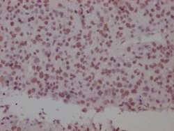Invitrogen SMC1 Recombinant Rabbit Monoclonal Antibody (8C11) 100 &mu;L;