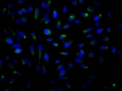 Invitrogen ROCK2 Recombinant Rabbit Monoclonal Antibody (10E1) 100 &mu;L;