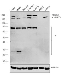 Invitrogen ROCK2 Recombinant Rabbit Monoclonal Antibody (10E1) 100 &mu;L;