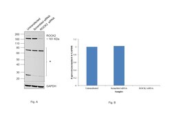Invitrogen ROCK2 Recombinant Rabbit Monoclonal Antibody (10E1) 100 &mu;L;