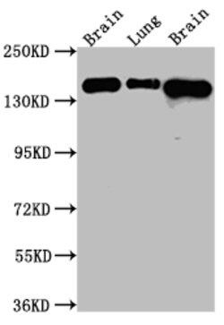 Invitrogen FGFR2 Recombinant Rabbit Monoclonal Antibody (2E9) 100 &mu;L | Buy Online | Invitrogen&trade; | Fisher Scientific