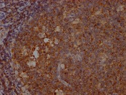 Invitrogen SHIP1 Recombinant Rabbit Monoclonal Antibody (9G11) 100 &mu;L;