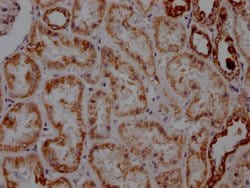 Invitrogen ATP5A1 Recombinant Rabbit Monoclonal Antibody (5G11) 100 &mu;L;