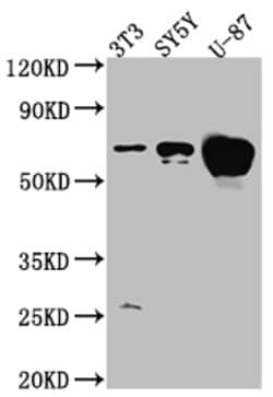 Invitrogen Estrogen Receptor alpha Recombinant Rabbit Monoclonal Antibody