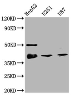 Invitrogen Nkx2.1 Recombinant Rabbit Monoclonal Antibody (6C11) 100 &mu;L | Buy Online | Invitrogen&trade; | Fisher Scientific
