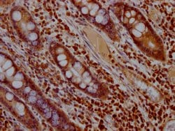 Invitrogen ERK2 Recombinant Rabbit Monoclonal Antibody (10C7) 100 &mu;L;