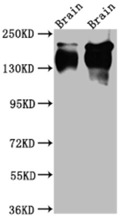 Invitrogen TrkA Recombinant Rabbit Monoclonal Antibody (2A5) 100 &mu;L;