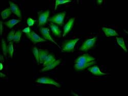 Invitrogen PCYT1A Recombinant Rabbit Monoclonal Antibody (4F2) 100 &mu;L;