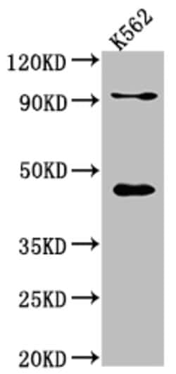 Invitrogen PCYT1A Recombinant Rabbit Monoclonal Antibody (4F2) 100 &mu;L;