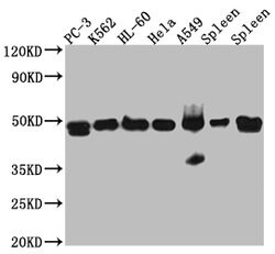 Invitrogen Arp3 Recombinant Rabbit Monoclonal Antibody (7E5) 100 &mu;L;