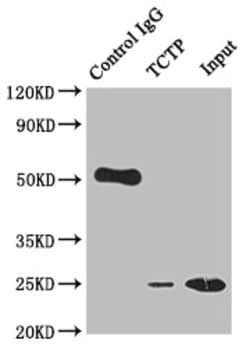 Invitrogen TPT1 Recombinant Rabbit Monoclonal Antibody (10A9) 100 &mu;L;