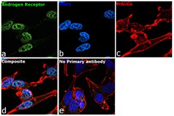 Invitrogen Androgen Receptor Recombinant Rabbit Monoclonal Antibody (5G7) 100 &mu;L | Buy Online | Invitrogen&trade; | Fisher Scientific