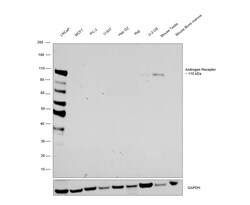 Invitrogen Androgen Receptor Recombinant Rabbit Monoclonal Antibody (5G7) 100 &mu;L | Buy Online | Invitrogen&trade; | Fisher Scientific