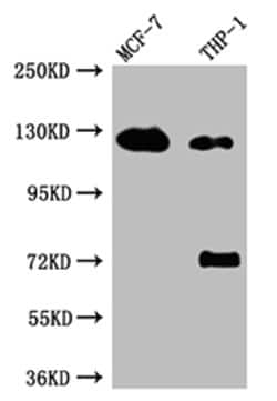 Invitrogen Androgen Receptor Recombinant Rabbit Monoclonal Antibody (5G7) 100 &mu;L | Buy Online | Invitrogen&trade; | Fisher Scientific