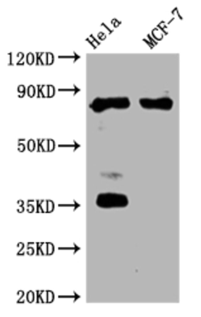 STAT3 Rabbit Monoclonal Antibody (3A9), Invitrogen 100 μL