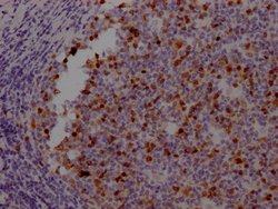 Invitrogen Aurora B Recombinant Rabbit Monoclonal Antibody (4E5) 100 &mu;L;