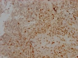 Invitrogen Aurora B Recombinant Rabbit Monoclonal Antibody (4E5) 100 &mu;L;