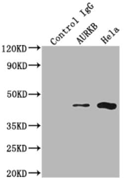 Invitrogen Aurora B Recombinant Rabbit Monoclonal Antibody (4E5) 100 &mu;L;