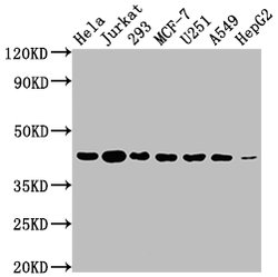 Invitrogen Aurora B Recombinant Rabbit Monoclonal Antibody (4E5) 100 &mu;L;