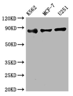 Invitrogen IKK beta Recombinant Rabbit Monoclonal Antibody (3E1) 100 &mu;L | Buy Online | Invitrogen&trade; | Fisher Scientific