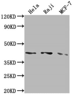 Invitrogen AGTR1 Recombinant Rabbit Monoclonal Antibody (4A9) 100 &mu;L;