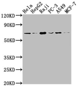 Invitrogen ALAS1 Recombinant Rabbit Monoclonal Antibody (2A9) 100 &mu;L;