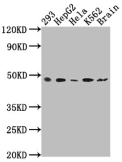 Invitrogen FNTB Recombinant Rabbit Monoclonal Antibody (5H4) 100 &mu;L | Buy Online | Invitrogen&trade; | Fisher Scientific