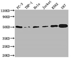 Invitrogen PTP1B Recombinant Rabbit Monoclonal Antibody (1G3) 100 &mu;L | Buy Online | Invitrogen&trade; | Fisher Scientific